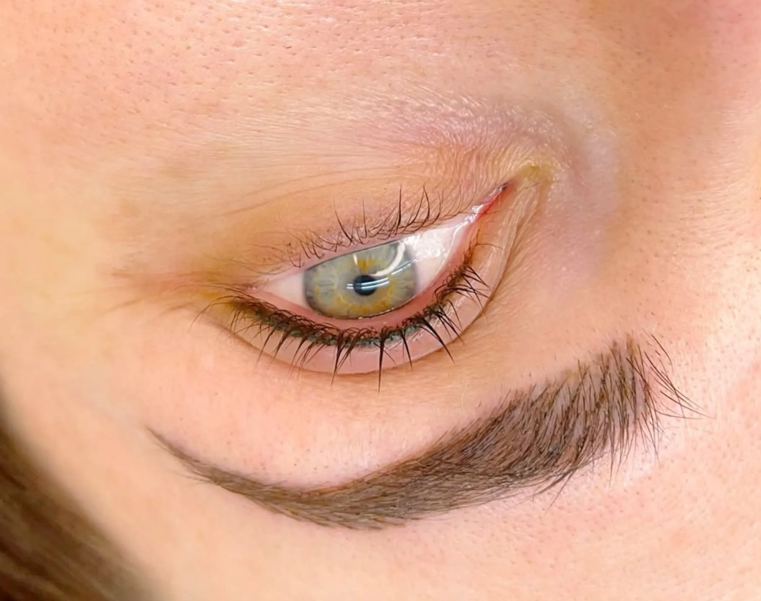 Eyeliner Tattoo Removal: Methods, Costs & Aftercare Guide