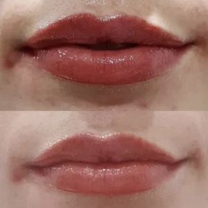 Can You Take Ibuprofen Before Lip Blushing?
