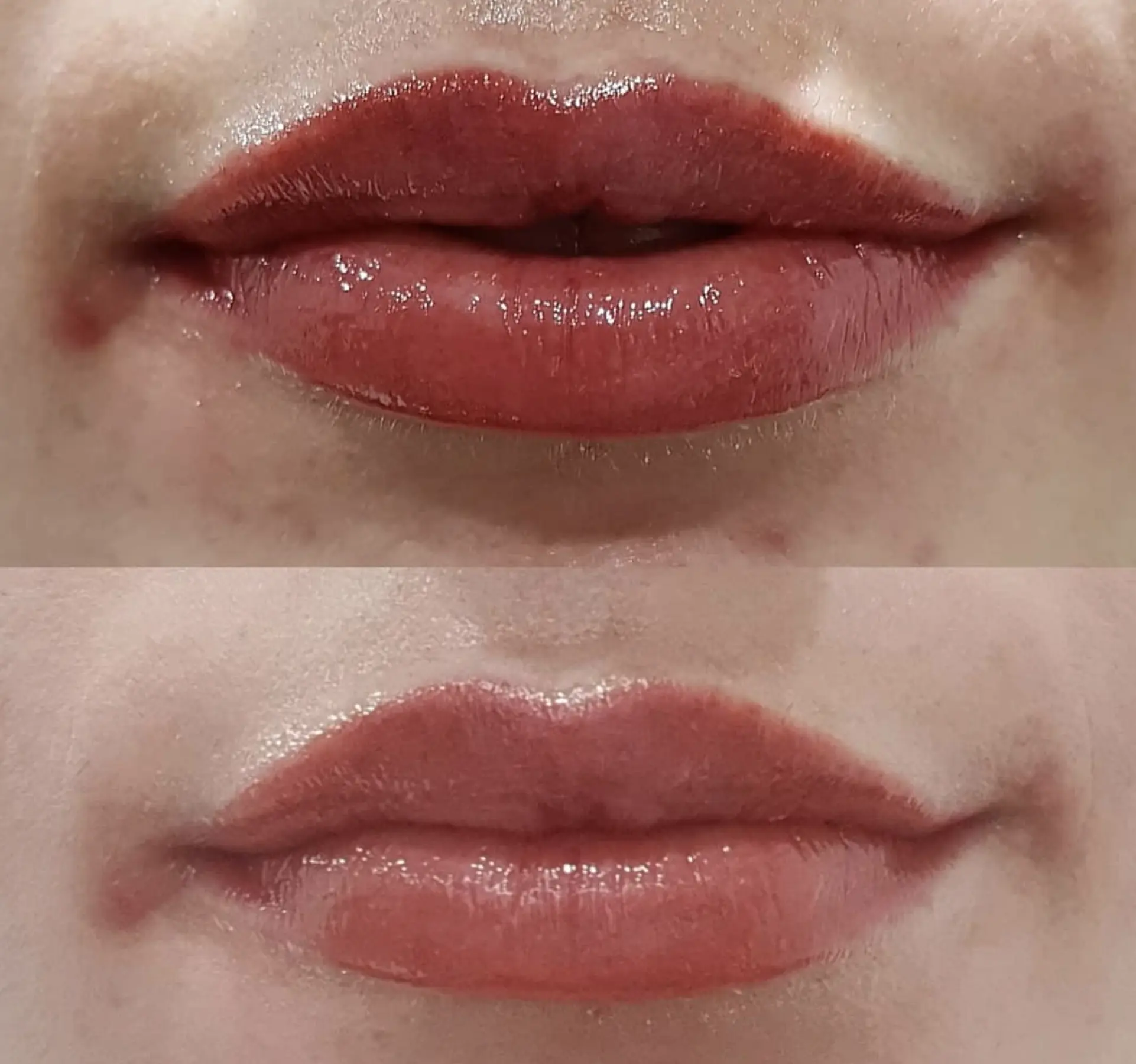 Can You Take Ibuprofen Before Lip Blushing?